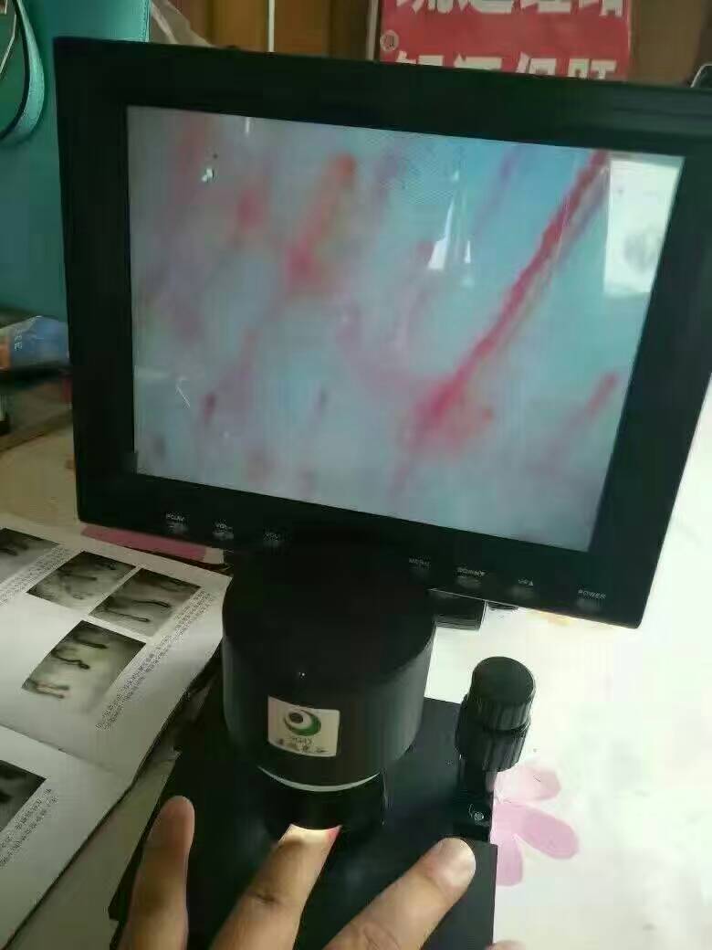 穿魔力鞋后微循环仪器上的血流的显示效果